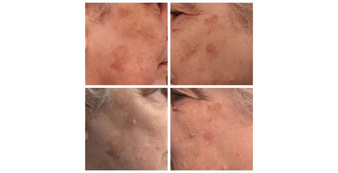 PommeClaire™ Apple Exosome Serum
Shop PommeClaire™
