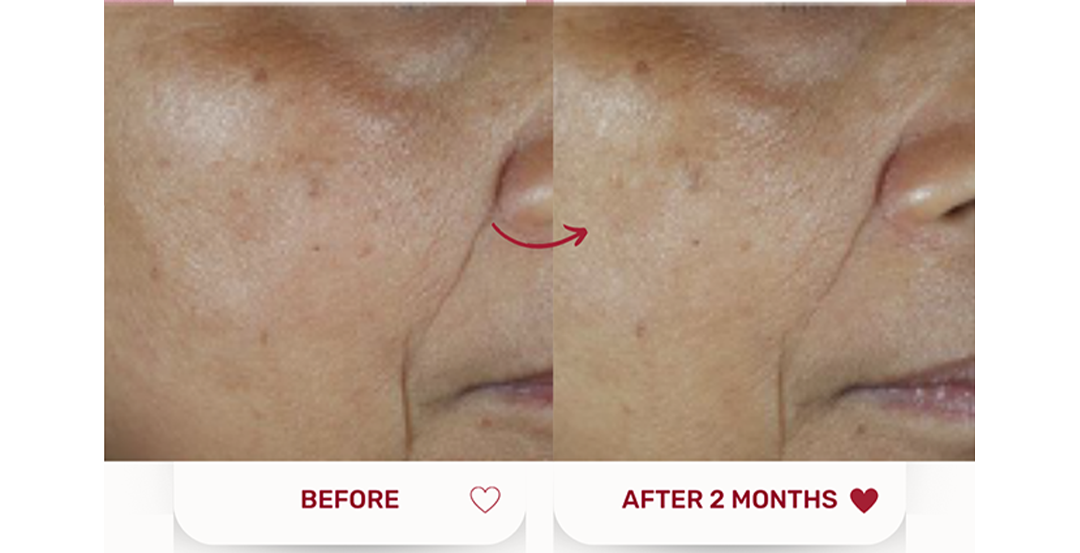 Bijou Serum for Menopausal Skin
Shop Bijou Serum